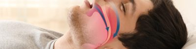 apneia-do-sono-1000x600-1.jpg